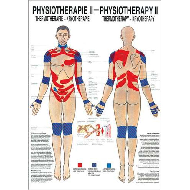 Poster Fysiotherapie II, thermo- & cryotherapie, 50 x 70 cm (E.600.0050)